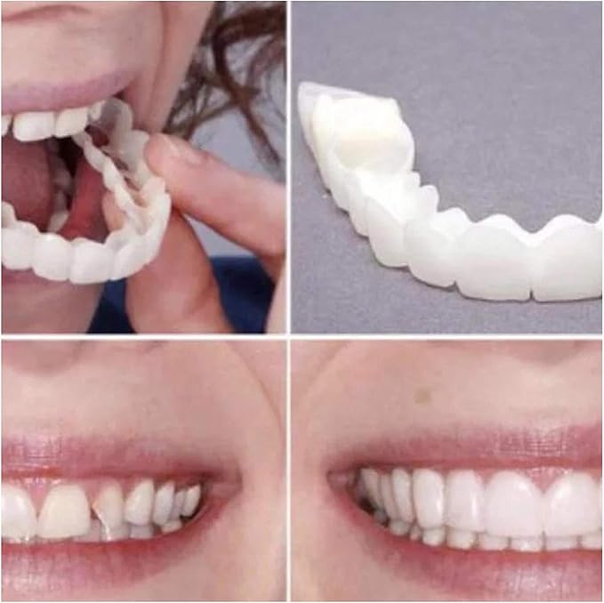 Snap On Smile Braces Teeth Kit For Men & Women